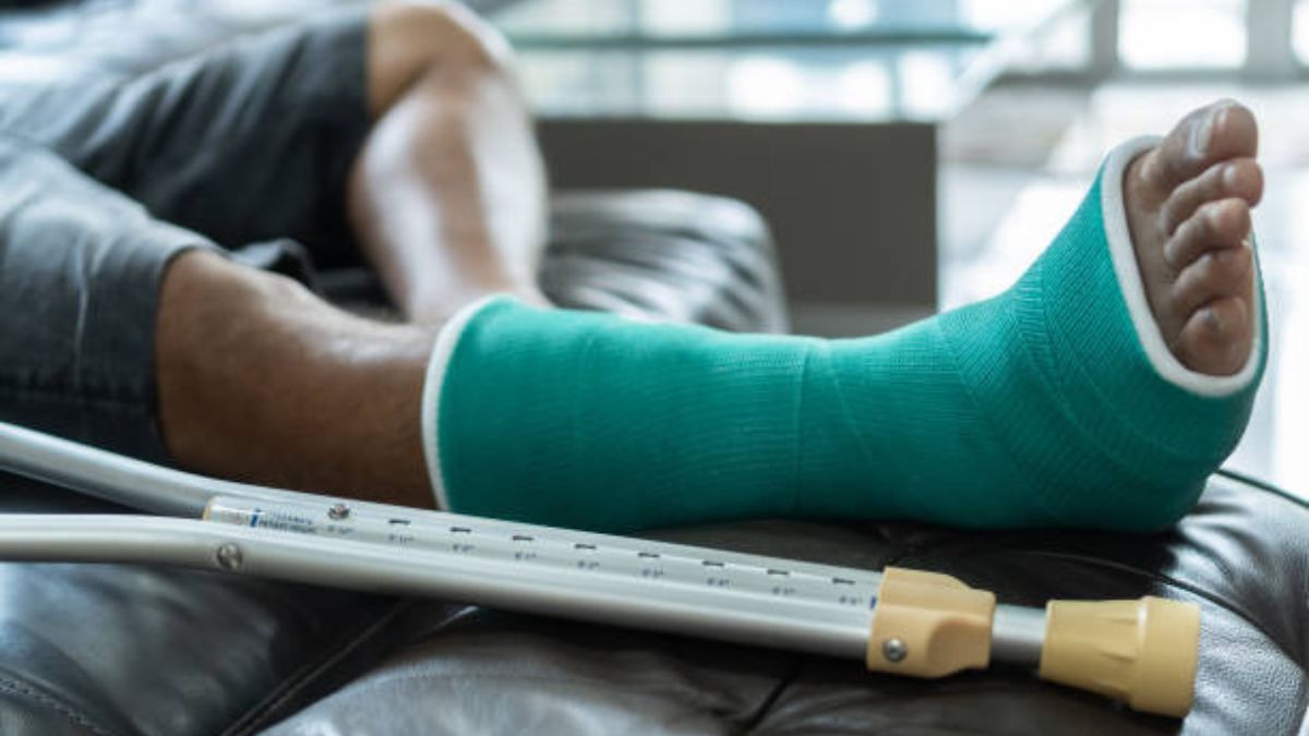 Life Expectancy After Compression Fracture